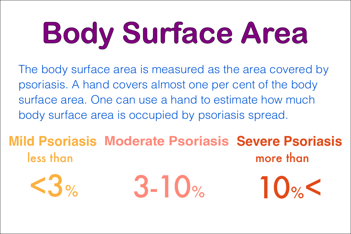 severity of psoriasis
