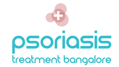 Psoriasis Treatment Bangalore