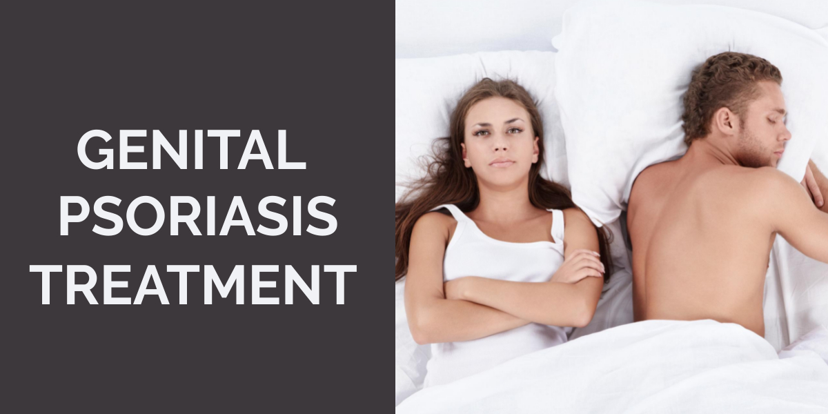 Genital Psoriasis Treatment