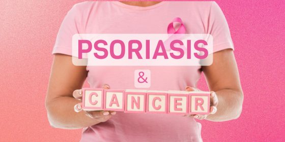 Can-psoriasis-cause-cancer