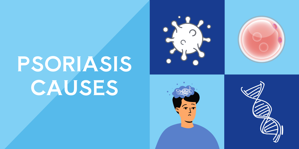 Psoriasis Causes