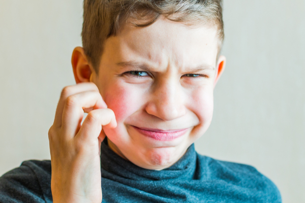 Psoriasis In Children image