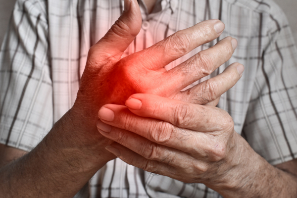 Psoriatic Arthritis image