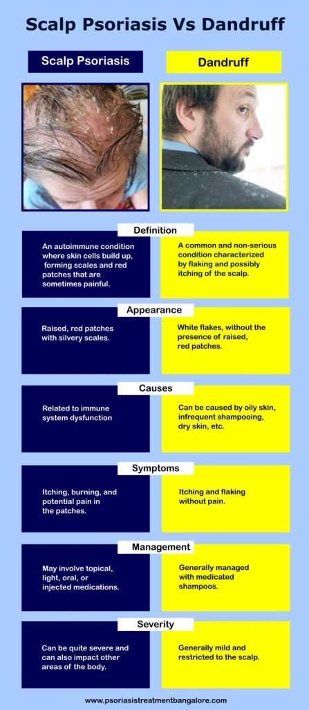 Difference Between Scalp Psoriasis and Dandruff