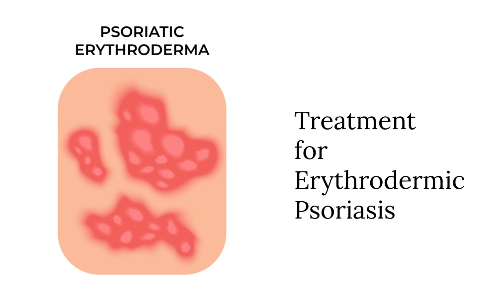 Erythrodermic Psoriasis