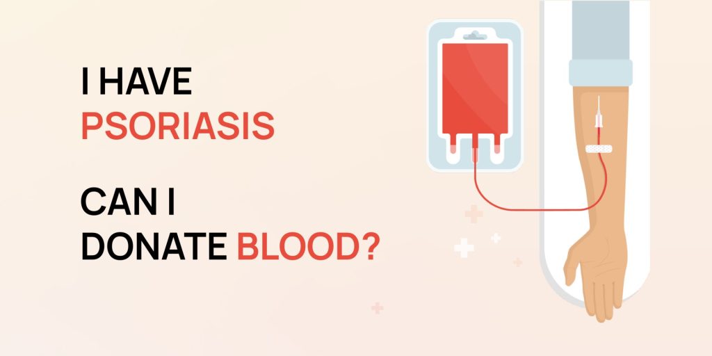 Can Psoriasis Patients Donate Blood
